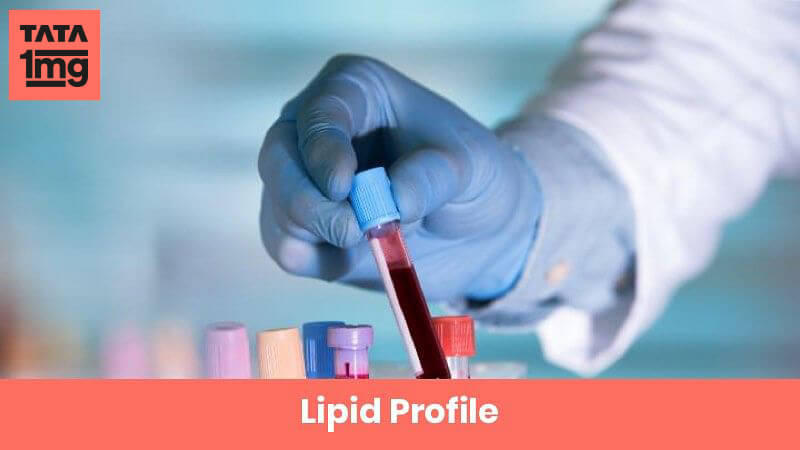 Lipid Profile